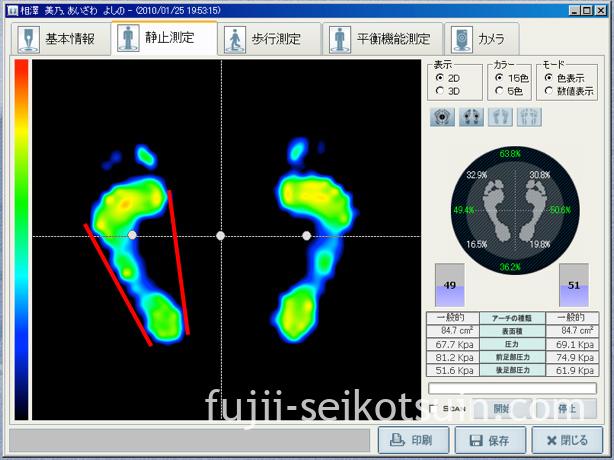 ナローな足＝足幅の細い足のデータ