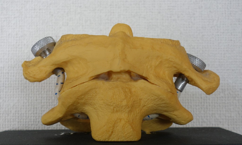 頸椎モデル1